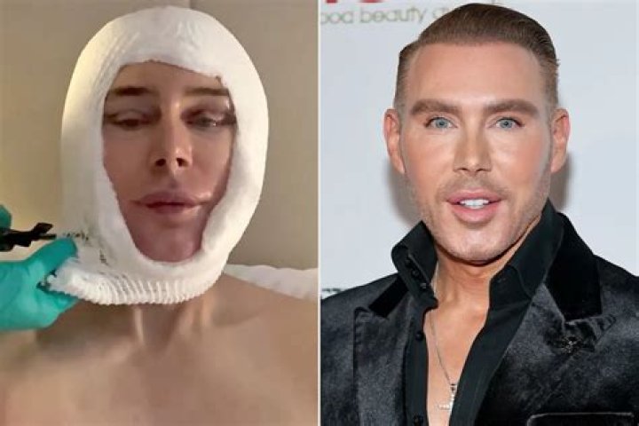 A Deep Dive Into His Plastic Surgery Journey