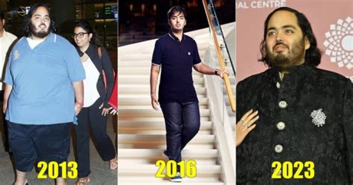 Anant Ambani's Health Concerns: Latest Updates And Speculations