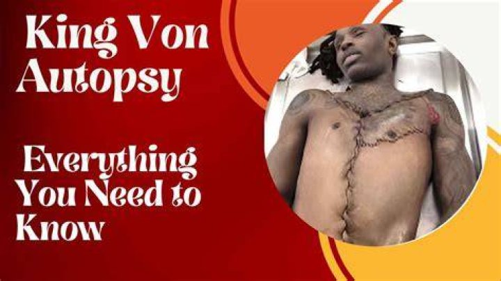 Autopsy Photo Reveals Horrific Details Of King Von's Passing