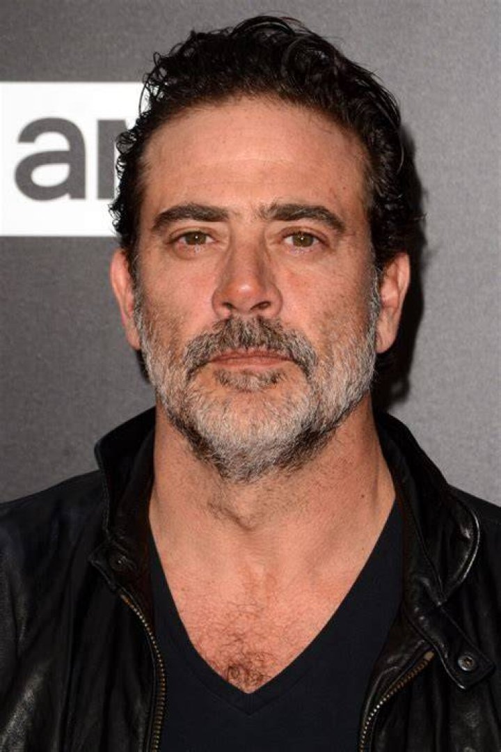 Cleft Lip Actor