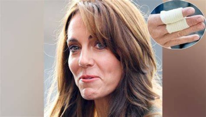 Does Kate Middleton's Appearance Stem From An Eating Disorder?