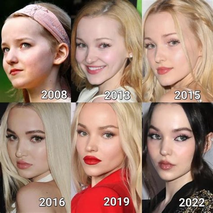 Dove Cameron Plastic Surgery: Truth Or Myth?