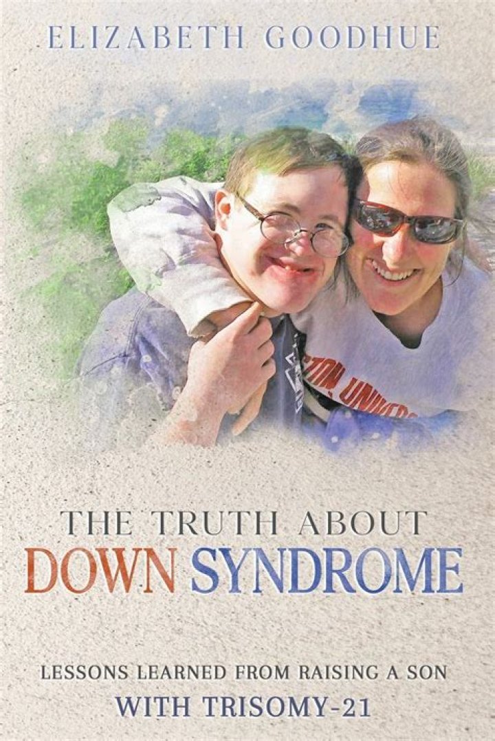 George Clooney's Son: The Truth About Down Syndrome