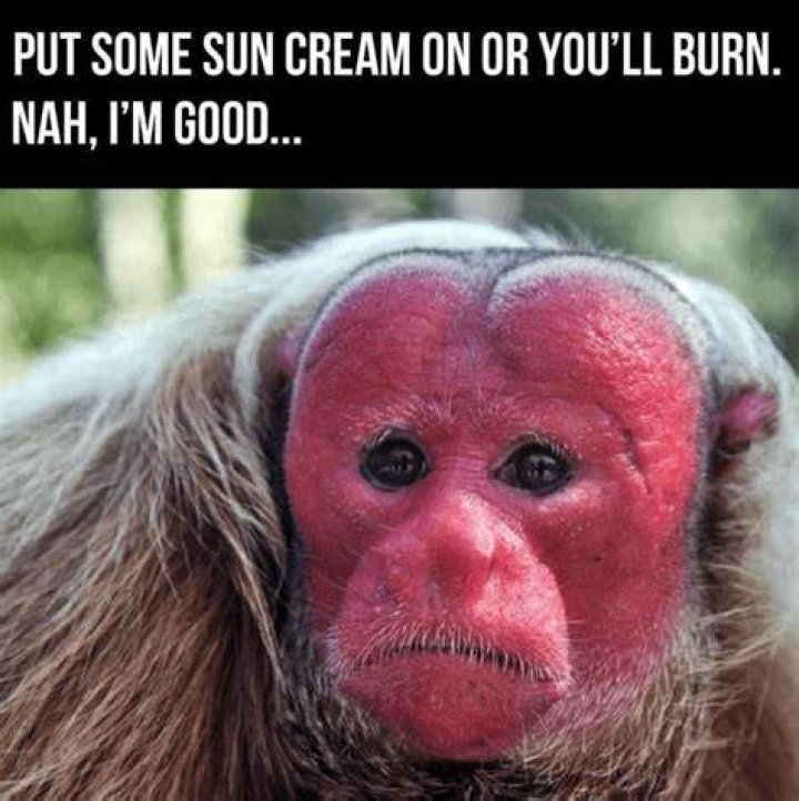 Hilarious Sunburn Quips: The Ultimate Guide To Sunburnt Humor