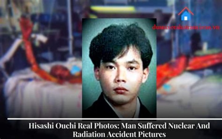 Hisashi Ouchi's Haunting Real-Life Photos