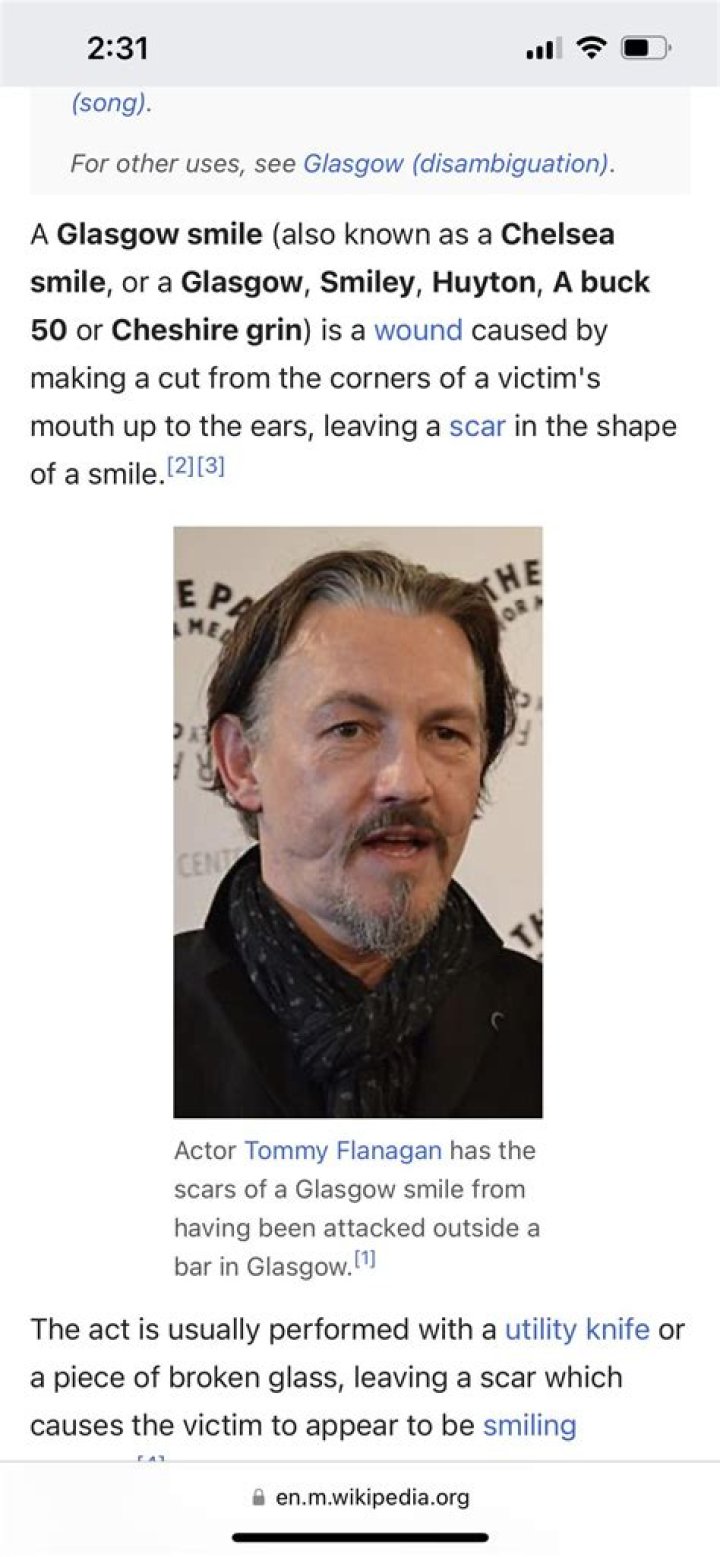 How Did Tommy Flanagan Get His Scars On His Face