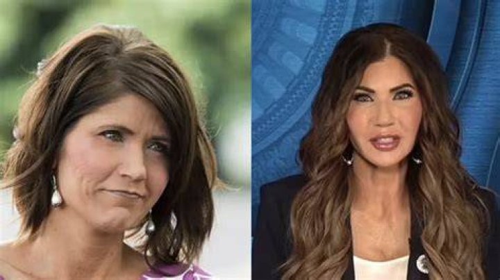 Kristi Noem's Stunning Transformation: Before And After