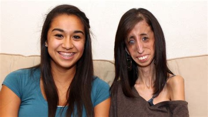 Meet The World's Thinnest Woman: A Medical Miracle