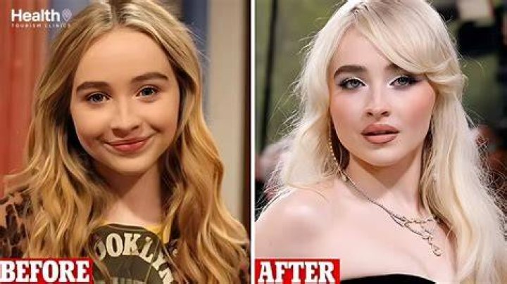 See How Sabrina Carpenter Has Transformed Post-Surgery!