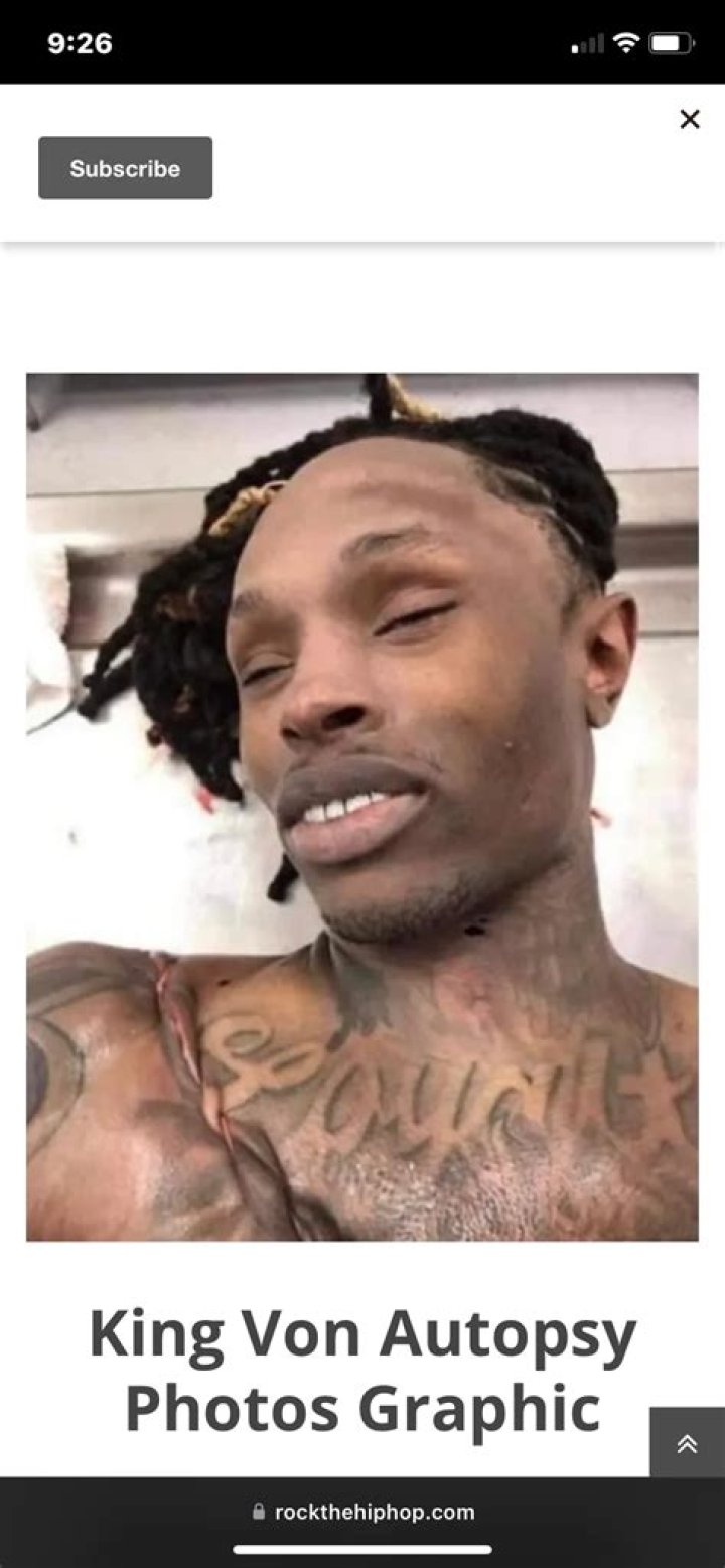 The Disturbing Truth: King Von Autopsy Photos Uncovered