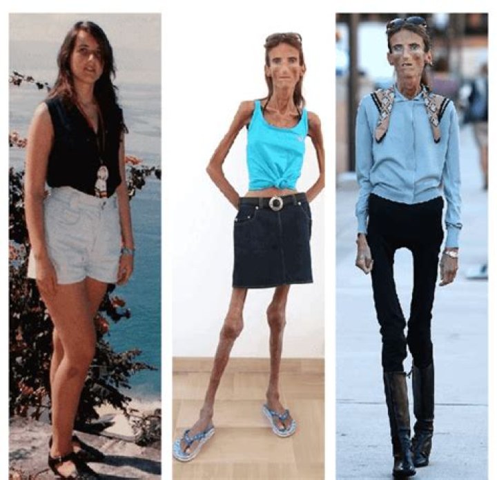 The Skinniest Person
