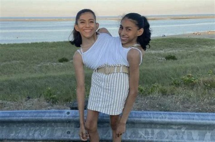 Unbelievable News About Twins On The Way
