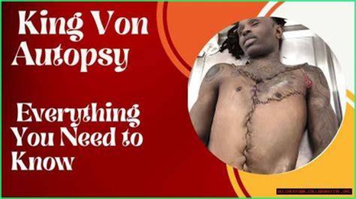 Uncover The Complete King Von Autopsy Report: A Comprehensive Analysis