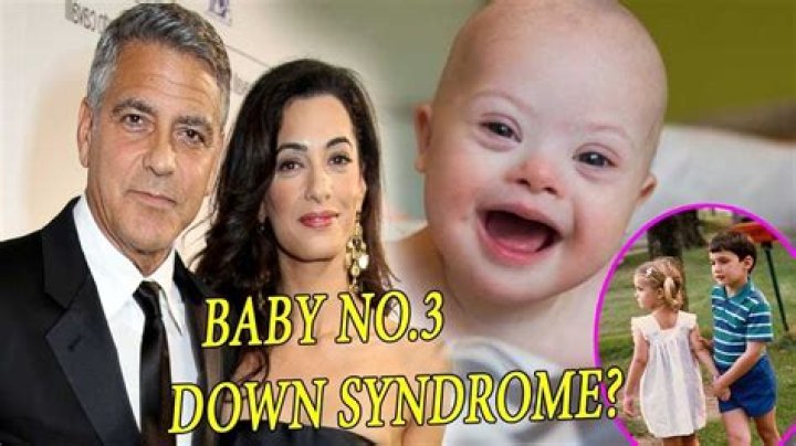 Uncovering The Truth About George Clooney's Child And Down Syndrome