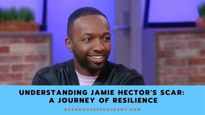 Uncovering The Untold Story: Jamie Hector's Face Scar