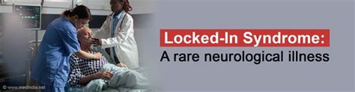 Understanding Locked In Syndrome: The Story Of Lacey