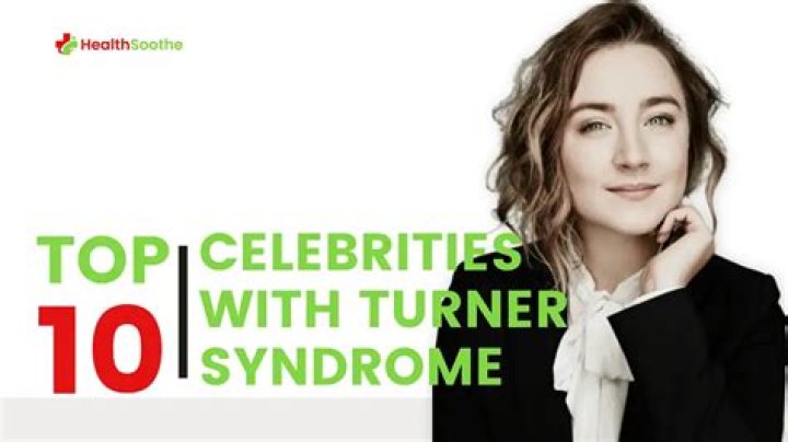 Unveiling The Extraordinary: Celebrities With Turner Syndrome