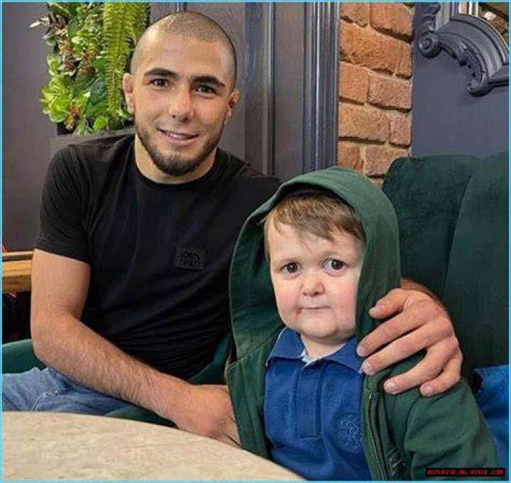 What Is Hasbulla Known For? The Truth About His Condition