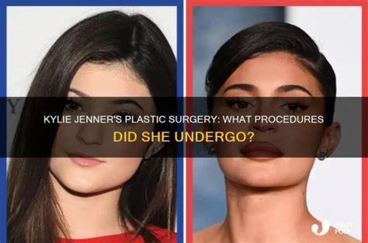 What Procedures Did He Undergo?