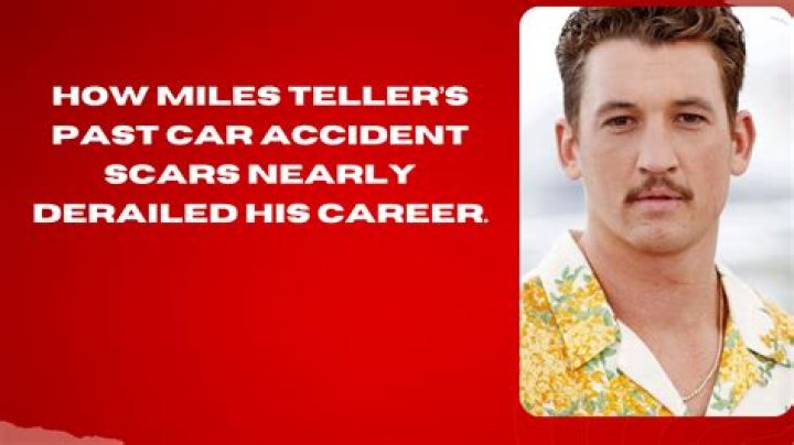 Why Does Miles Teller Have So Many Scars
