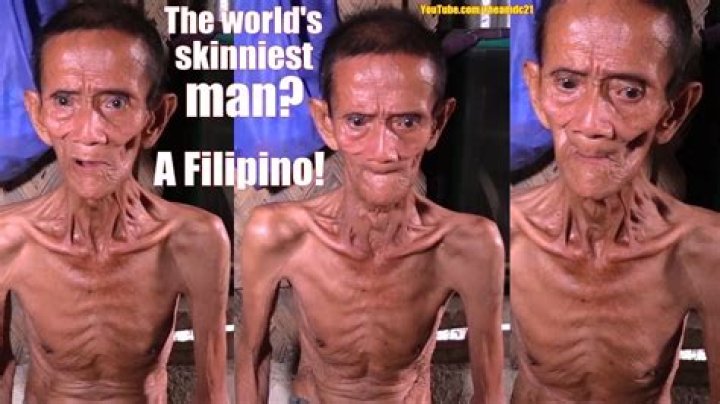 Worlds Skinniest Man